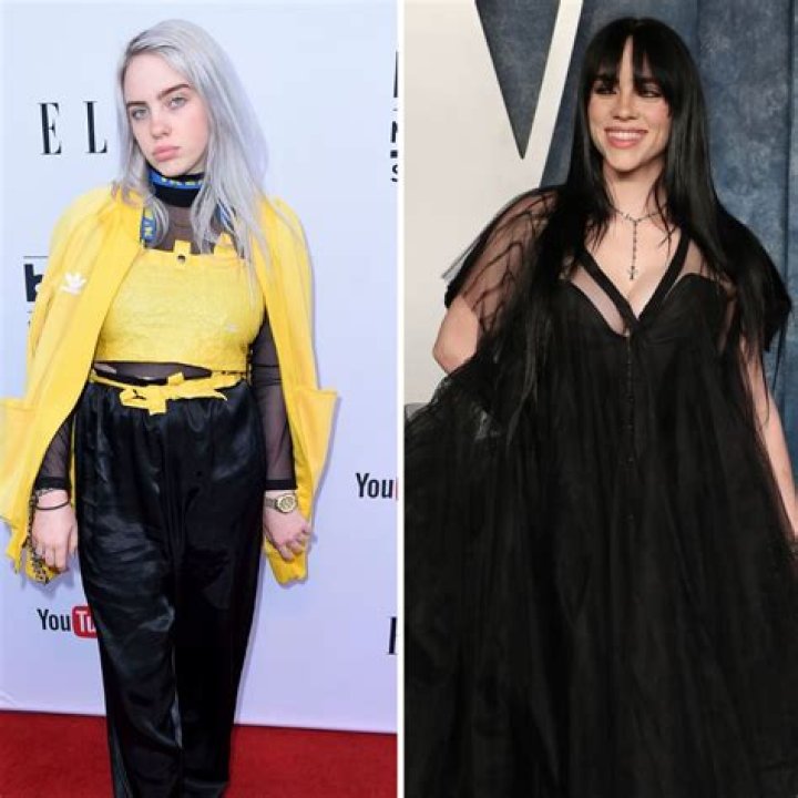 Did Billie Eilish Have Breast Reduction? Exploring the Truth Behind the Rumors